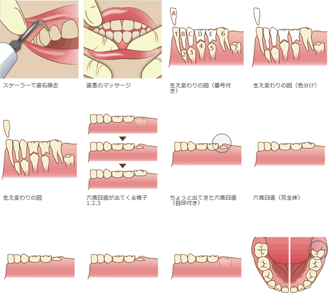 治療内容のイラスト